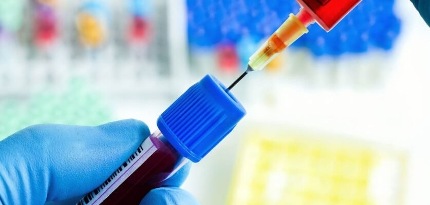 Розуміння коефіцієнта атерогенності: біохімія та здоров’я серця