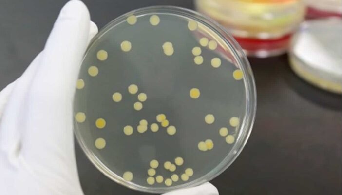 Золотистий стафілокок: Невидимий ворог, який загрожує здоров’ю людини