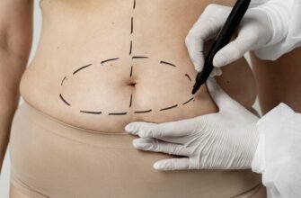 Абдомінопластика: що це таке та як відбувається процедура корекції живота?