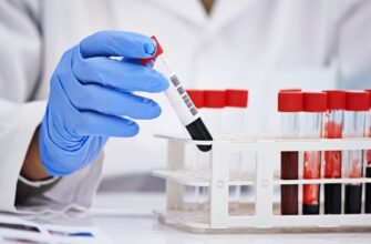 Зрозуміти, що таке біохімічний аналіз крові: важливість та методи