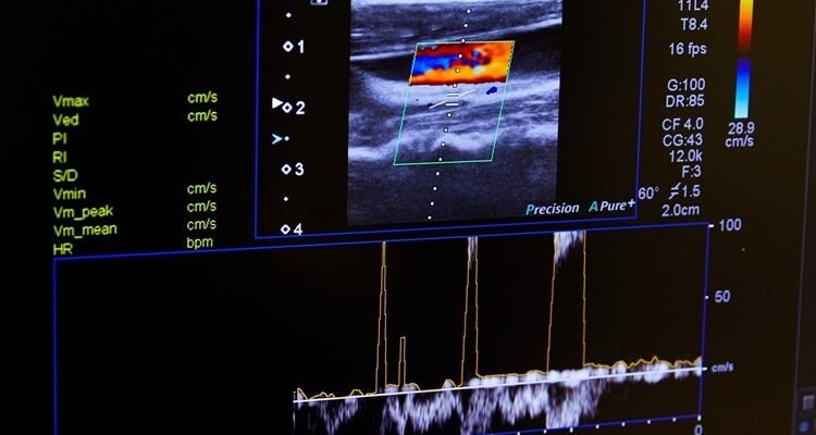 Що таке доплер: основи, принципи роботи та практичні застосування