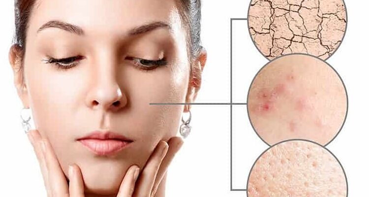 Що таке іхтіоз: причини, симптоми та методи лікування захворювання