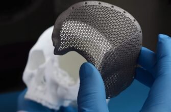 Що таке імпланти: сутність, види та переваги сучасних технологій