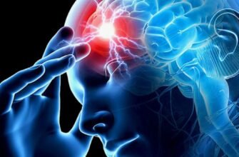 Інсульт: визначення, симптоми та ефективні методи лікування