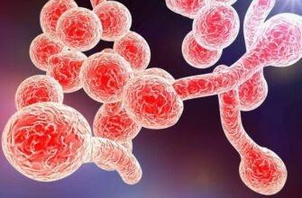 Відкрийте для себе кандидоз: причини, симптоми та ефективне лікування