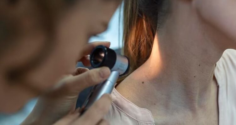 Кератома: Види, Причини та Лікування Доброякісного Утворення Шкіри