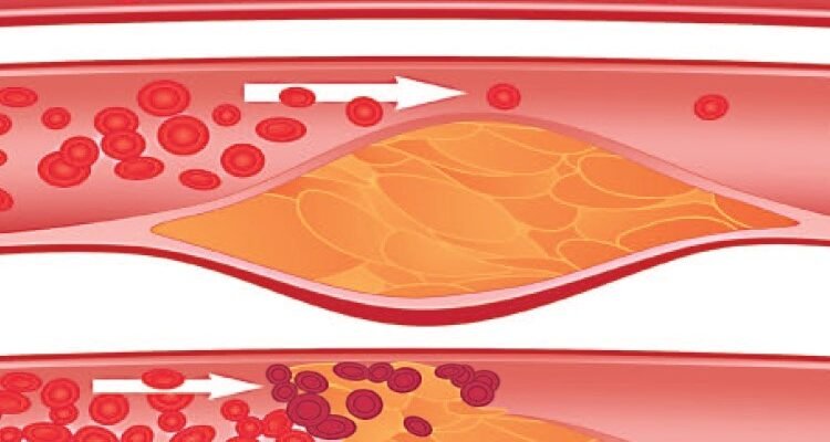 Оклюзія: детальний аналіз поняття та впливу на здоров’я зубів Оклюзія: детальний аналіз поняття та впливу на здоров’я зубів