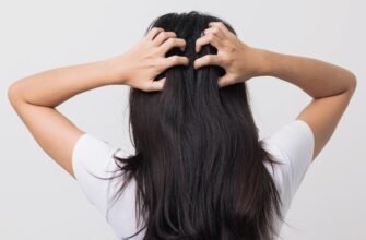 Що таке перхоть: причини, симптоми та ефективні методи лікування