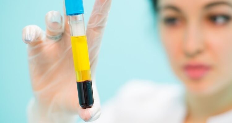 Плазма крові: склад, функції та значення для організму людини