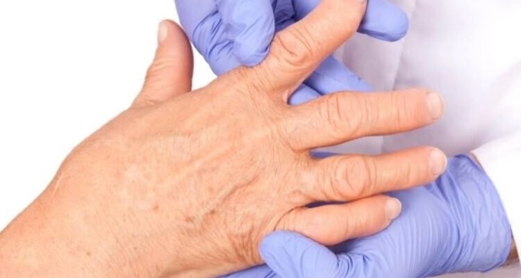 Детальний огляд ревмопроб: що це таке і як впливає на здоров’я? Детальний огляд ревмопроб: що це таке і як впливає на здоров’я?